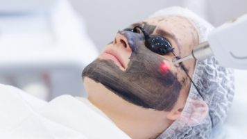 Tratamiento facial Peeling “Hollywood”